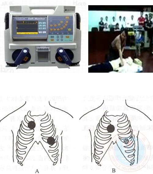 电击除颤-乐山市人民医院