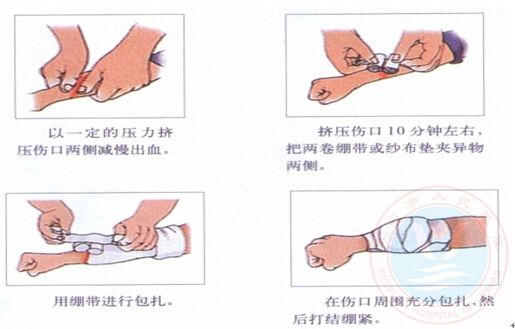 外伤的包扎与止血