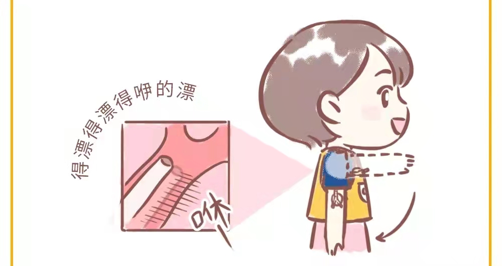 肿瘤血液科成功开展患者picc导管异位颈内静脉复位