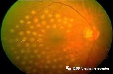 眼底内科.jpg 眼底内科.jpg