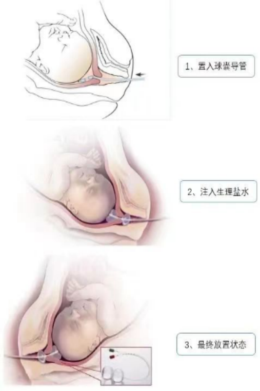 图片3(1).png 图片3(1).png