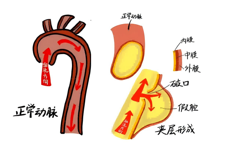 夹层(1).png 夹层(1).png